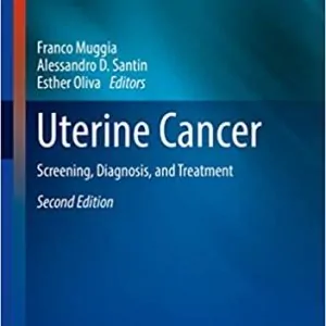 Uterine Cancer: Screening, Diagnosis, and Treatment (2nd Edition) - eBook