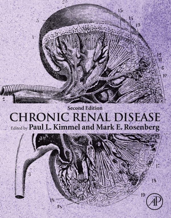 Chronic Renal Disease (2nd Edition) - eBook