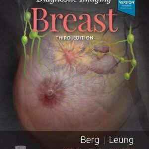 Diagnostic Imaging Breast 3Rd Edition – PDF ebook