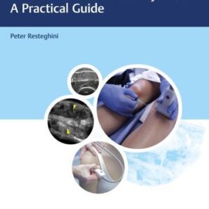 Diagnostic Musculoskeletal Ultrasound And Guided Injection A Practical Guide – PDF ebook