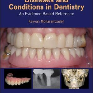 Diseases And Conditions In Dentistry An Evidence Based Reference – PDF ebook