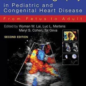 Echocardiography In Pediatric And Congenital Heart Disease From Fetus To Adult 2Nd Edition – PDF ebook