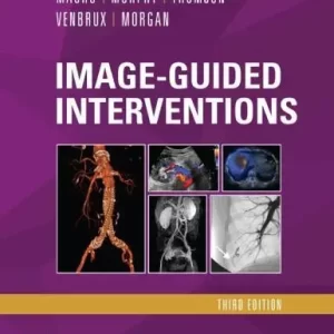Image Guided Interventions Expert Radiology Series 3Rd Edition – PDF ebook