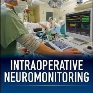 Intraoperative Neuromonitoring – PDF ebook
