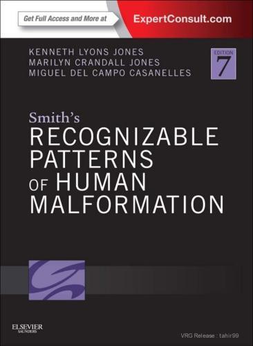 Smiths Recognizable Patterns Of Human Malformation 7Th Edition – PDF ebook